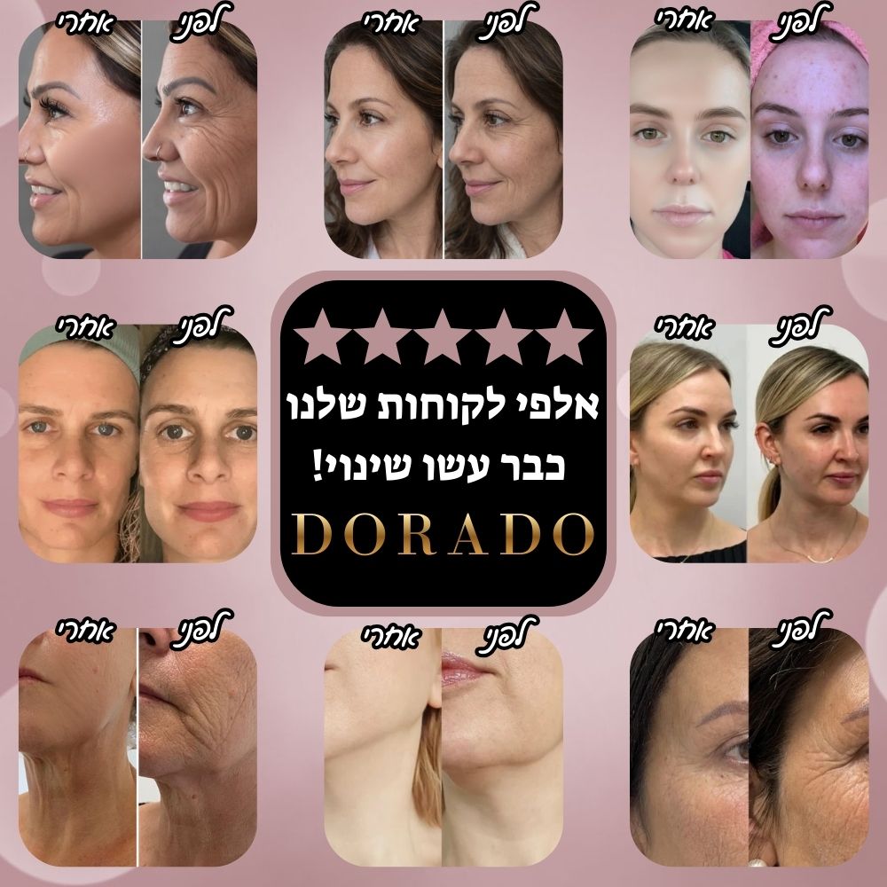 מכשיר חיטוב ומיצוק הפנים והצוואר ™DoradoGlow